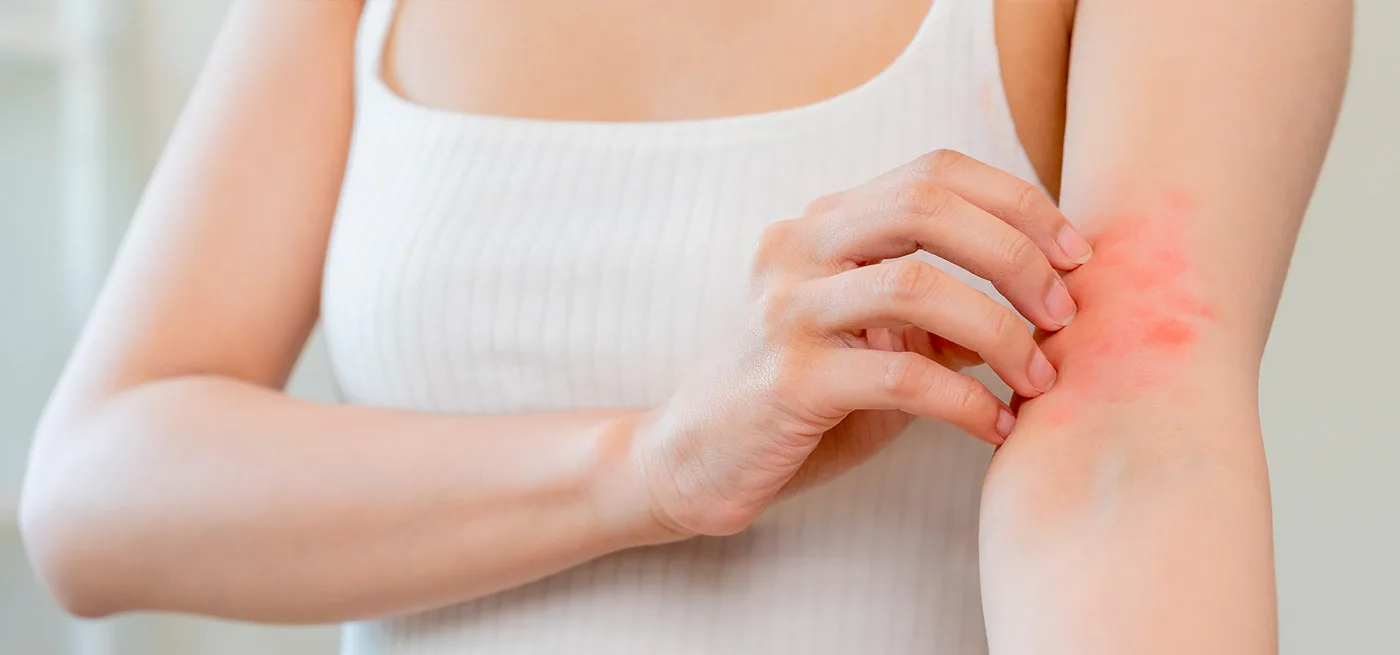 Ebglyss é Aprovado no Brasil: Conheça o Medicamento