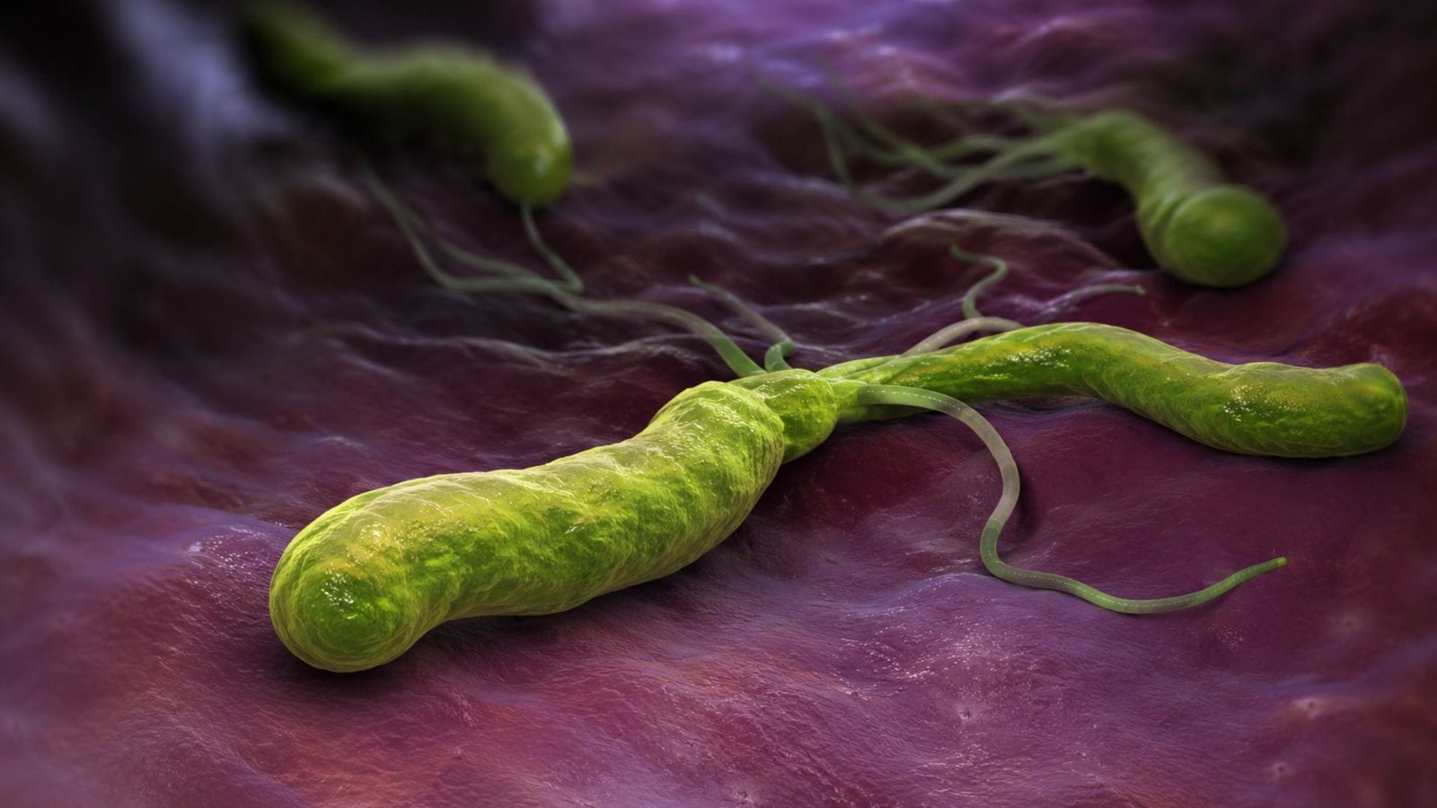 Como o PYLERA ajuda a erradicar a bactéria Helicobacter pylori