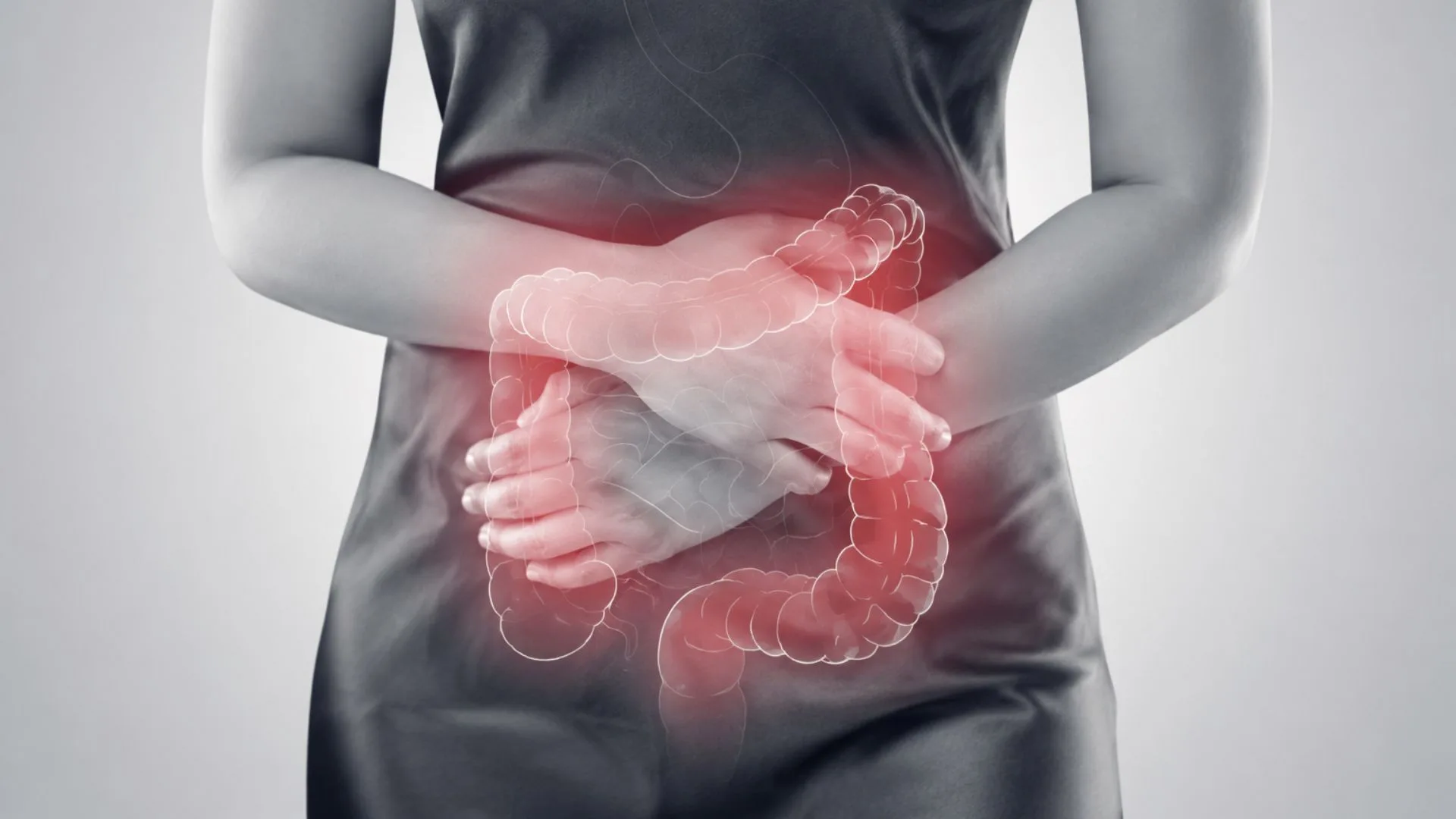 CORTIMENT Prolonged Release (Budesonida): tratamento para doenças inflamatórias intestinais