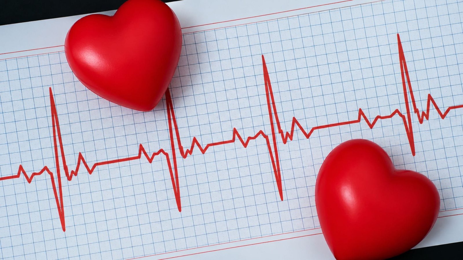 Fibrilação atrial e MULTAQ