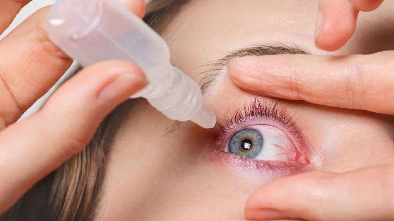 GLANATEC no tratamento do glaucoma